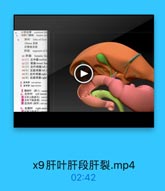 x9肝叶肝段肝裂.mp4