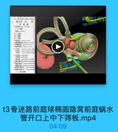 t3骨迷路前庭球椭圆隐窝前庭蜗水管开口上中下筛板.mp4