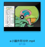 o 4-5 cerebellum
1.小脑的外用
1 4-8 cerebellar vermis
2 +M1 cerebellar hemisphe
4 t8 peduncle of flocculus
5 1:100 superior medullary veh
10 /ta nodule
11 MA lingula
12 中央小计 central lobule
13 t culmen
14 tt declive
15 M2t folium of vermis
16 45 tuber of vermis
17 #l## pyramid of verm
18 #1 uvula of vermis
2.小脑的分叶
20 l W( primary fissure)
21 后外侧裂 posterolaterail fl

a小脑外形分叶.mp4
07:29