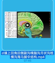 · 34 顺横回(tmnwerse lemp
·35 融上淘 superior temp

2

◎36 蘭上回
superior temp
●37 M中回
middle tempo
● 38 聚下沟
inferior temp

5

. 39 % Fo inferior tempo

6

♥ 40 顯顶叶岛盖 frontopa
· 新叶岛盖 1emporal of

7

◎中央旁小叶(panscenlrs

8

● 41 餅藍体(curpris callasu
· 42 透明局(Iranspurent weT
· 43 距状沟(ealearine salen
· 视叶 cuneus
44 餅服体沟 callosal su
扣带沟 cingulate sulc

1

45 扣带回(cingulale gyrus
46 前合 anlerior comm
47 嗅沟 offactory sulcus
噢束沟(nHfactory groove

t E FxnocAy

d缘上回角回侧副沟嗅脑沟月状沟枕
横沟海马脚伞结构.mp4

07:45