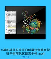 ●岛长回
long gyrus
P 53 前穿质
anterior per
◆ 斜角带
diagonal ba
◎ 54 海马沟 hippocampal
e 55 海马旁回(parabippi
656 钩(anrus)

E2 OE OL

、57 齿状回(dentate wvru
● 58 海马(hippocampus)
◎59 海马结构(hippocam)
D 60 海马脚 pes hippoci
·61 海马伞 fimbria of
● 边缘系统 limbic sy
0 边缘叶 limbic lobe
e(二)端脑的内部结构

O3 TE VE

◎ 1.基底核[basal nucl

SE SL

北称基底神经节(hasal

eEer

(1) 纹状体(corpas sE
62尾状核(caudate mueles
豆状核(lentiform muele

e基底核尾豆壳苍白球屏杏侧脑室视
听平衡嗅味区语言中枢.mp4

09:08